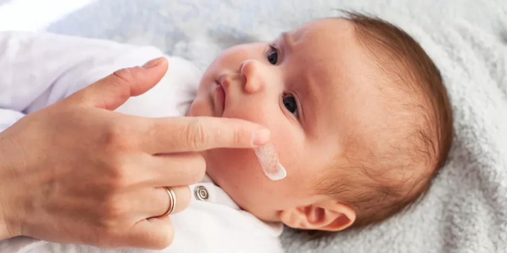 What Is the Best Way to Treat Baby Eczema? What Is the Best Way to Treat Baby Eczema?